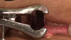 Oynat Bondage Kaltak Islanır: Tıbbi Odada Caning & Pussy Cezası, Bölüm 2